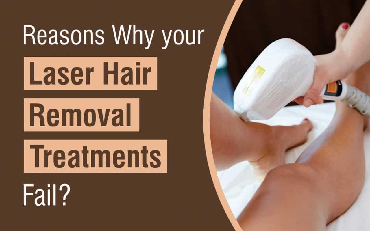 Reasons Why your Laser Hair Removal Treatments Fail?