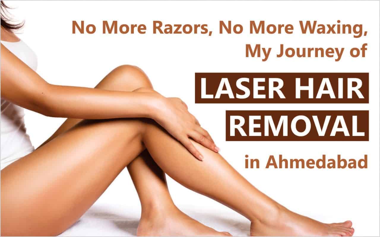 No More Razors, No More Waxing: My Journey of Laser Hair Removal in Ahmedabad